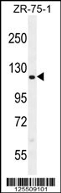 Western blot analysis in ZR-75-1 cell line lysates (35ug/lane).