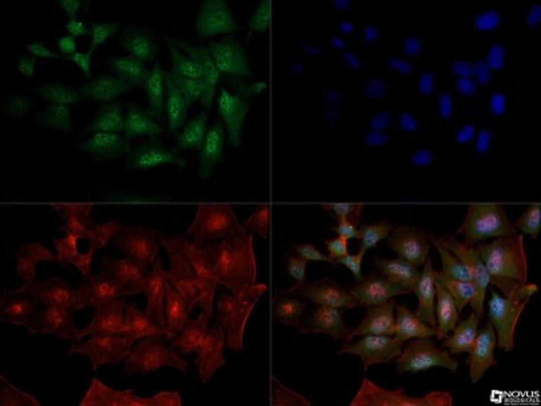 Immunocytochemistry/Immunofluorescence: DNMT1 Antibody (60B1220.1) [NB100-56519] - Dnmt1 antibody was tested in HeLa cells with Dylight 488 (green). Nuclei and alpha-tubulin were counterstained with DAPI (blue) and Dylight 550 (red). An antibody dilution of 1:10 was used. Image objective 40x.