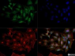 Immunocytochemistry/Immunofluorescence: DNMT1 Antibody (60B1220.1) [NB100-56519] - Dnmt1 antibody was tested in HeLa cells with Dylight 488 (green). Nuclei and alpha-tubulin were counterstained with DAPI (blue) and Dylight 550 (red). An antibody dilution of 1:10 was used. Image objective 40x.