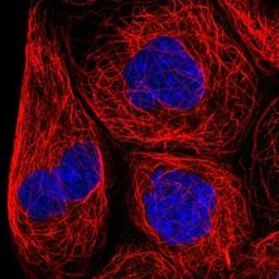 Immunocytochemistry/Immunofluorescence: STARD5 Antibody [NBP1-92449] - Staining of human cell line A-431 shows no positivity.