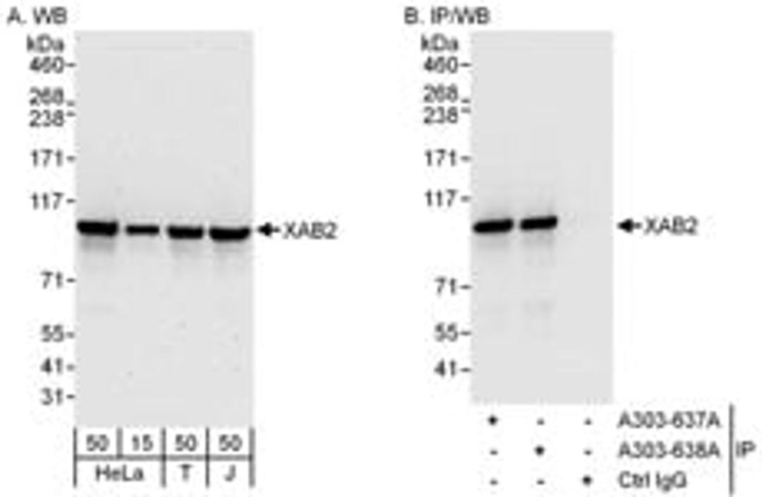 Detection of human XAB2 by western blot and immunoprecipitation.