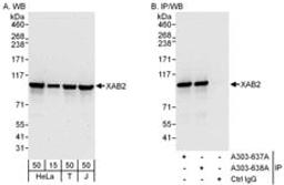 Detection of human XAB2 by western blot and immunoprecipitation.