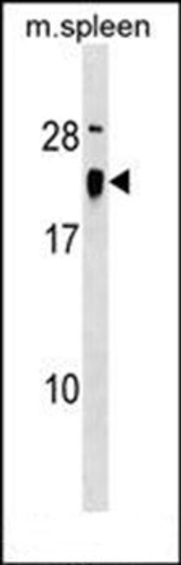 Western blot analysis of mouse spleen tissue lysates (35ug/lane) using ALG13 (Center) antibody