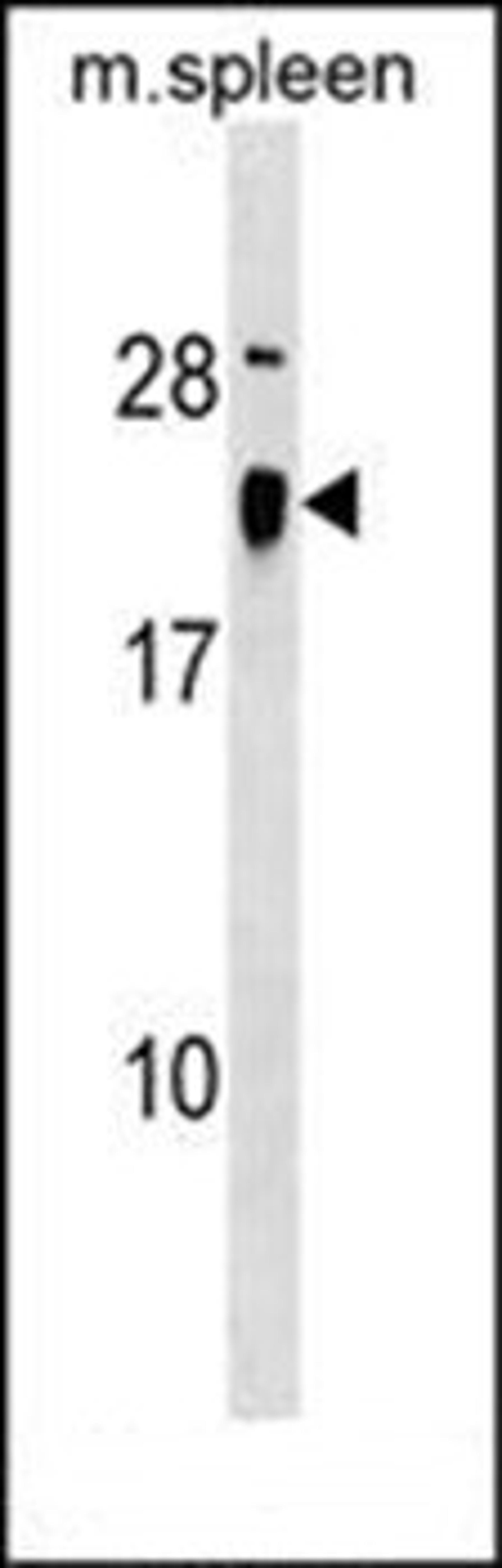 Western blot analysis of mouse spleen tissue lysates (35ug/lane) using ALG13 (Center) antibody