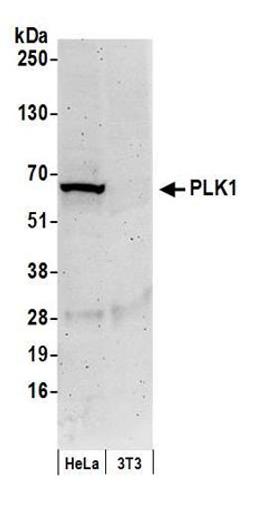 Detection of human PLK1 by western blot.