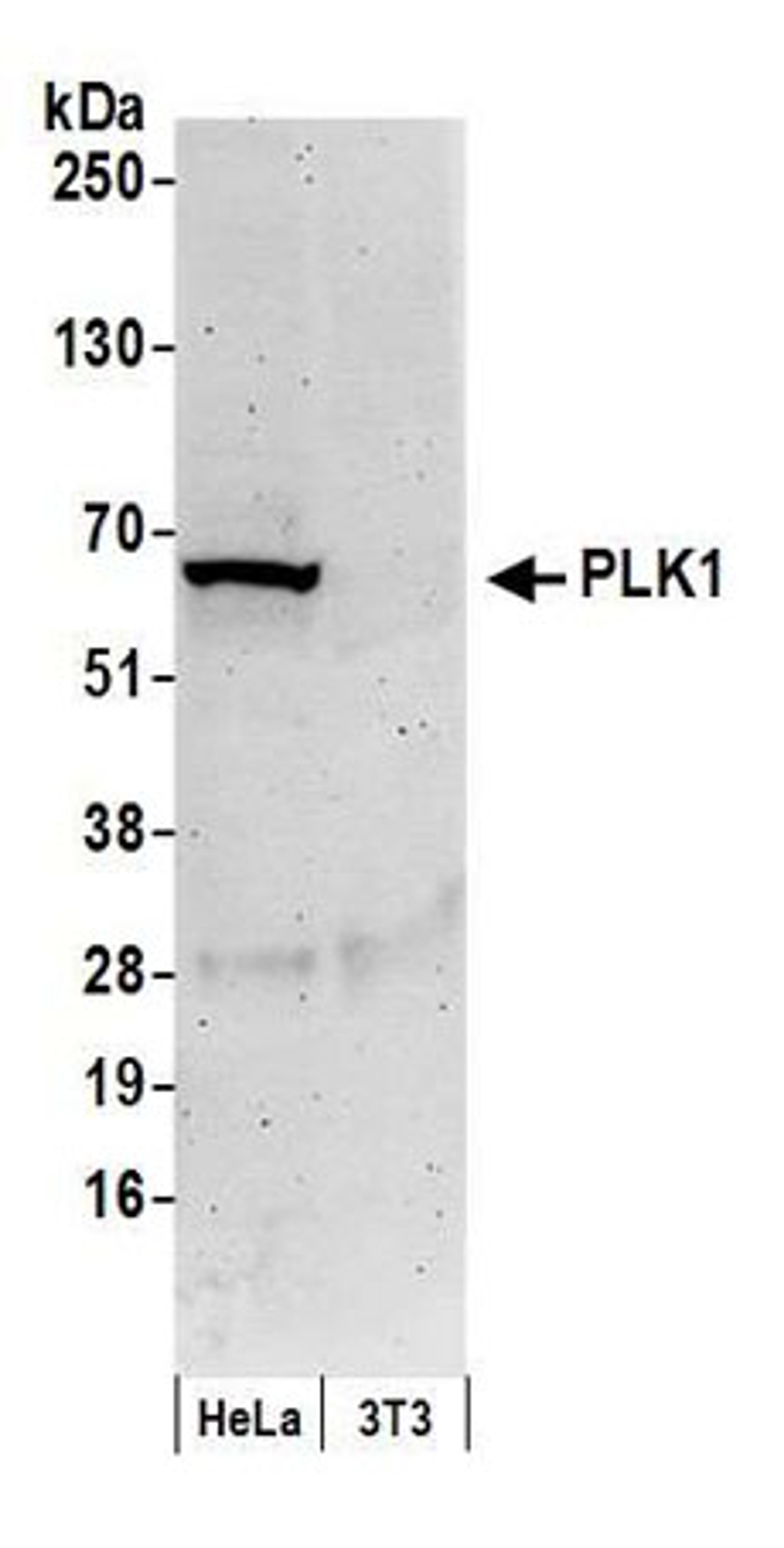 Detection of human PLK1 by western blot.