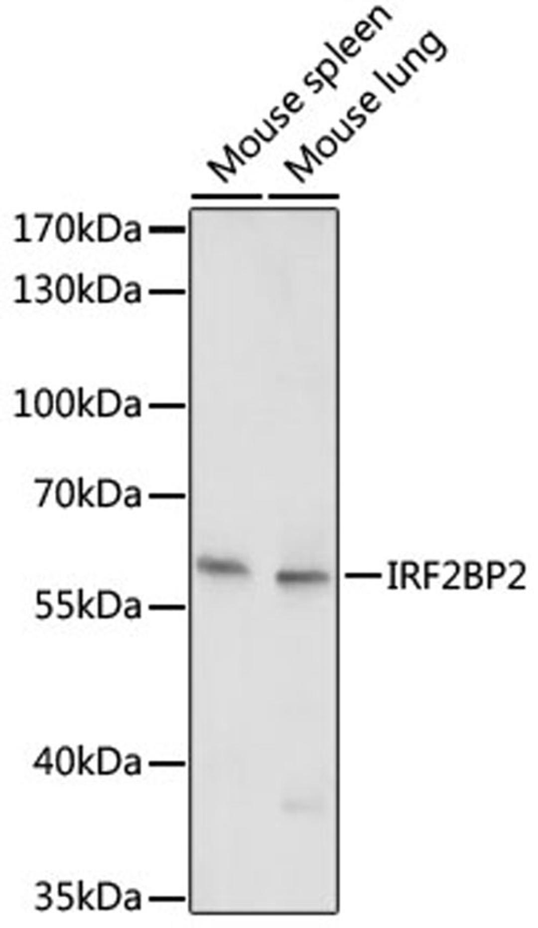 Western blot - IRF2BP2 antibody (A17985)