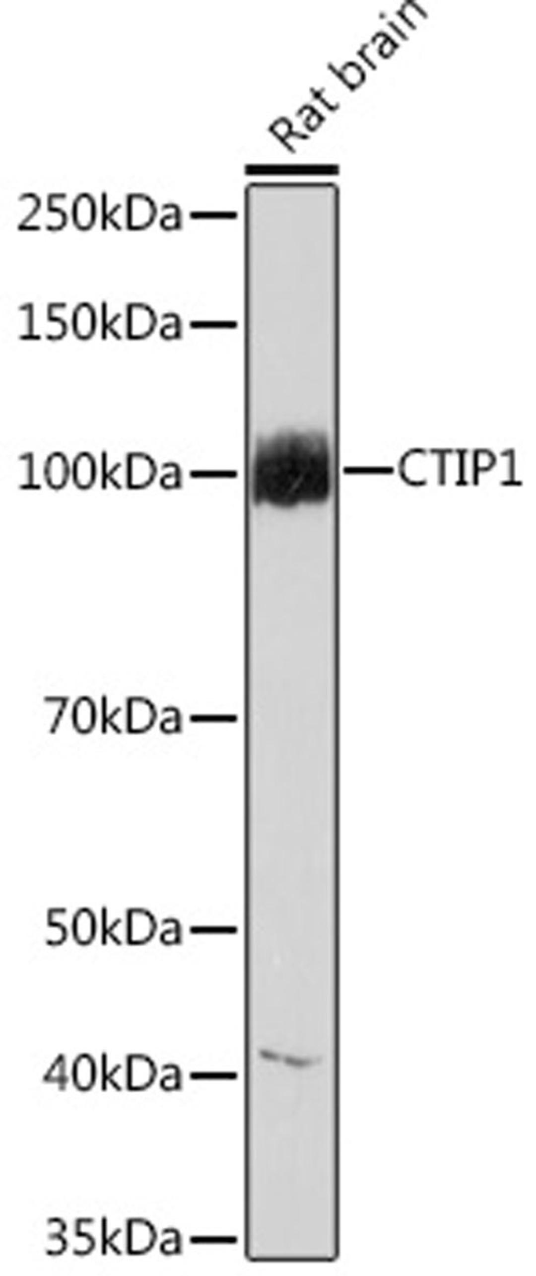 Western blot - CTIP1 Rabbit mAb (A9231)