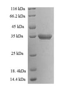 (Tris-Glycine gel) Discontinuous SDS-PAGE (reduced) with 5% enrichment gel and 15% separation gel.