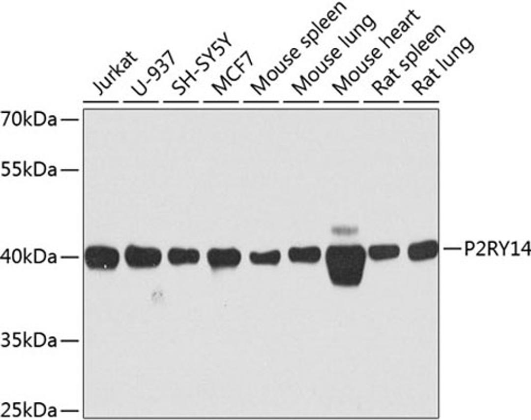 Western blot - P2RY14 antibody (A8178)