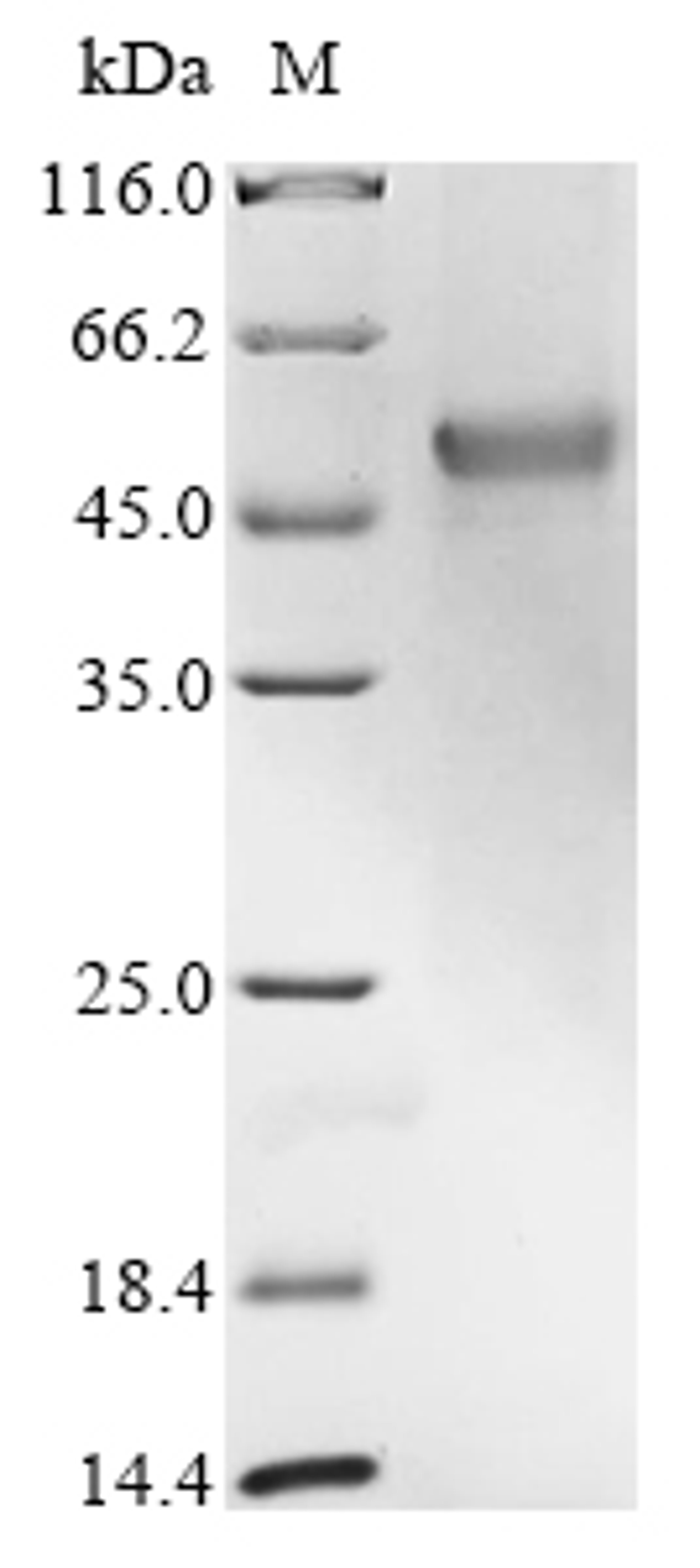 (Tris-Glycine gel) Discontinuous SDS-PAGE (reduced) with 5% enrichment gel and 15% separation gel.