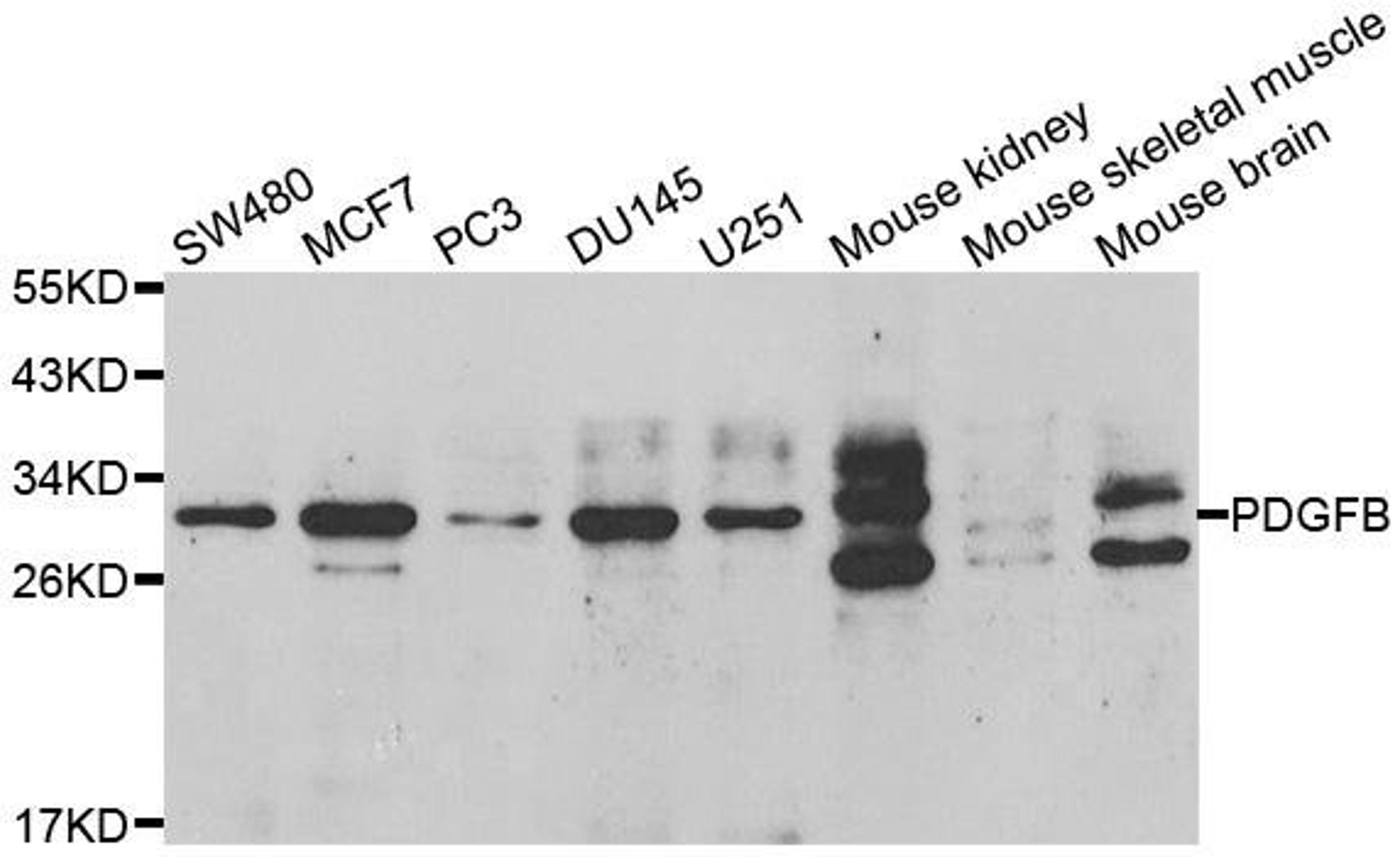 Western blot analysis of extracts of various cell lines using PDGFB antibody