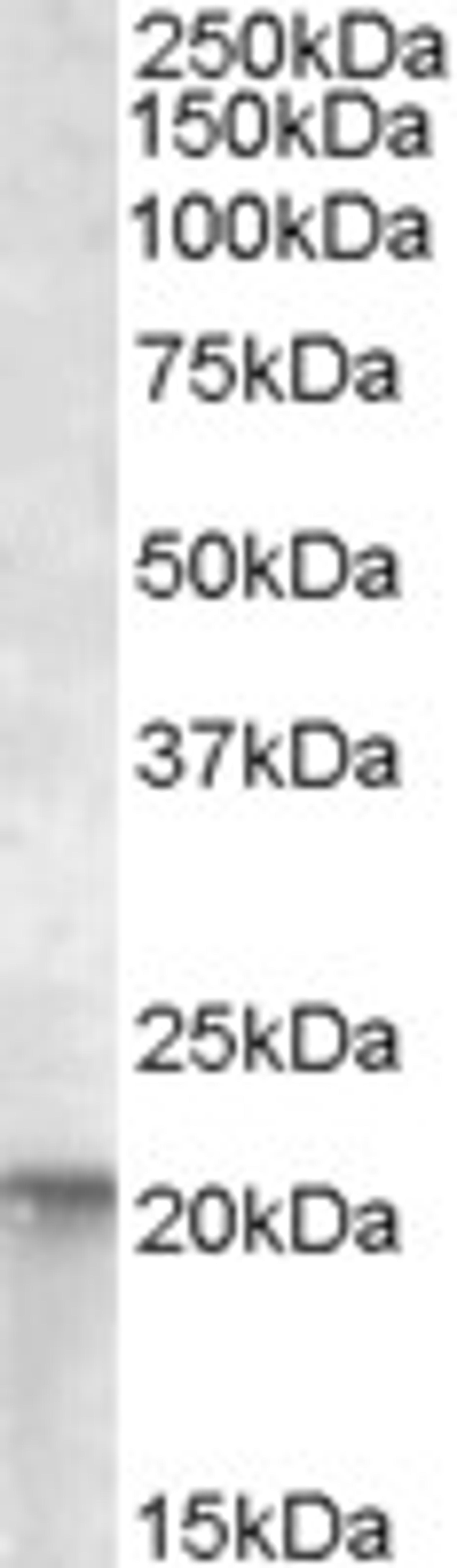 45-982 (0.01ug/ml) staining of A431 lysate (35ug protein in RIPA buffer). Primary incubation was 1 hour. Detected by chemiluminescence.