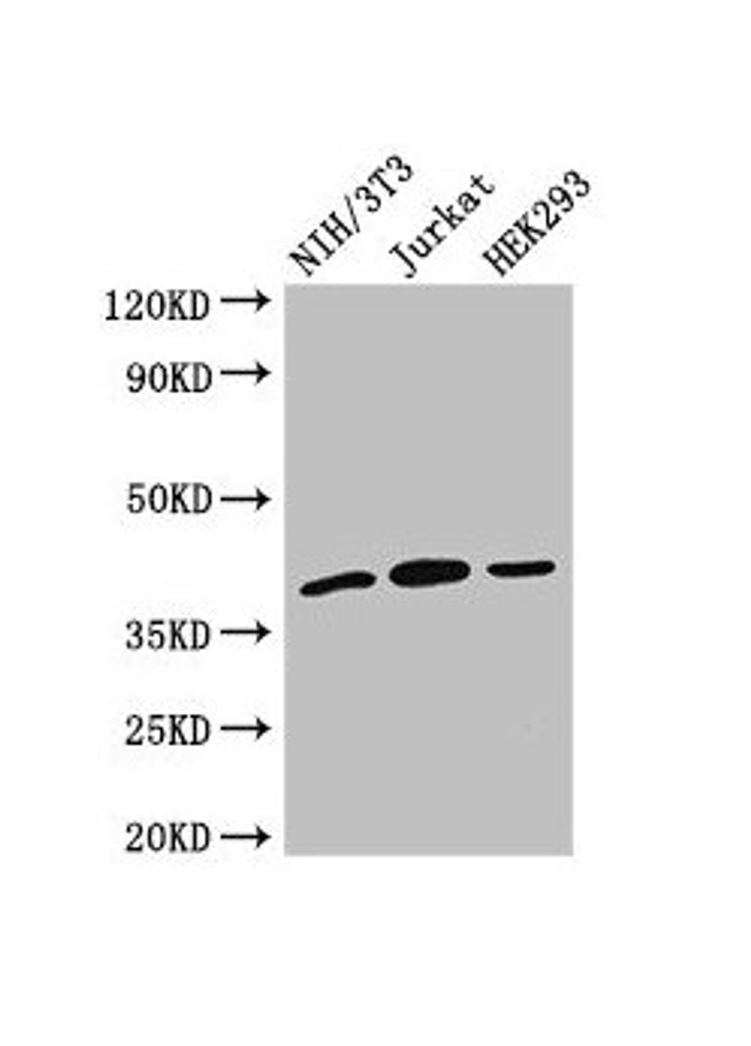 Western Blot. Positive WB detected in: NIH/3T3 whole cell lysate, Jurkat whole cell lysate, HEK293 whole cell lysate. All lanes: SPRY2 antibody at 2.7µg/ml. Secondary. Goat polyclonal to rabbit IgG at 1/50000 dilution. Predicted band size: 40 kDa. Observed band size: 40 kDa