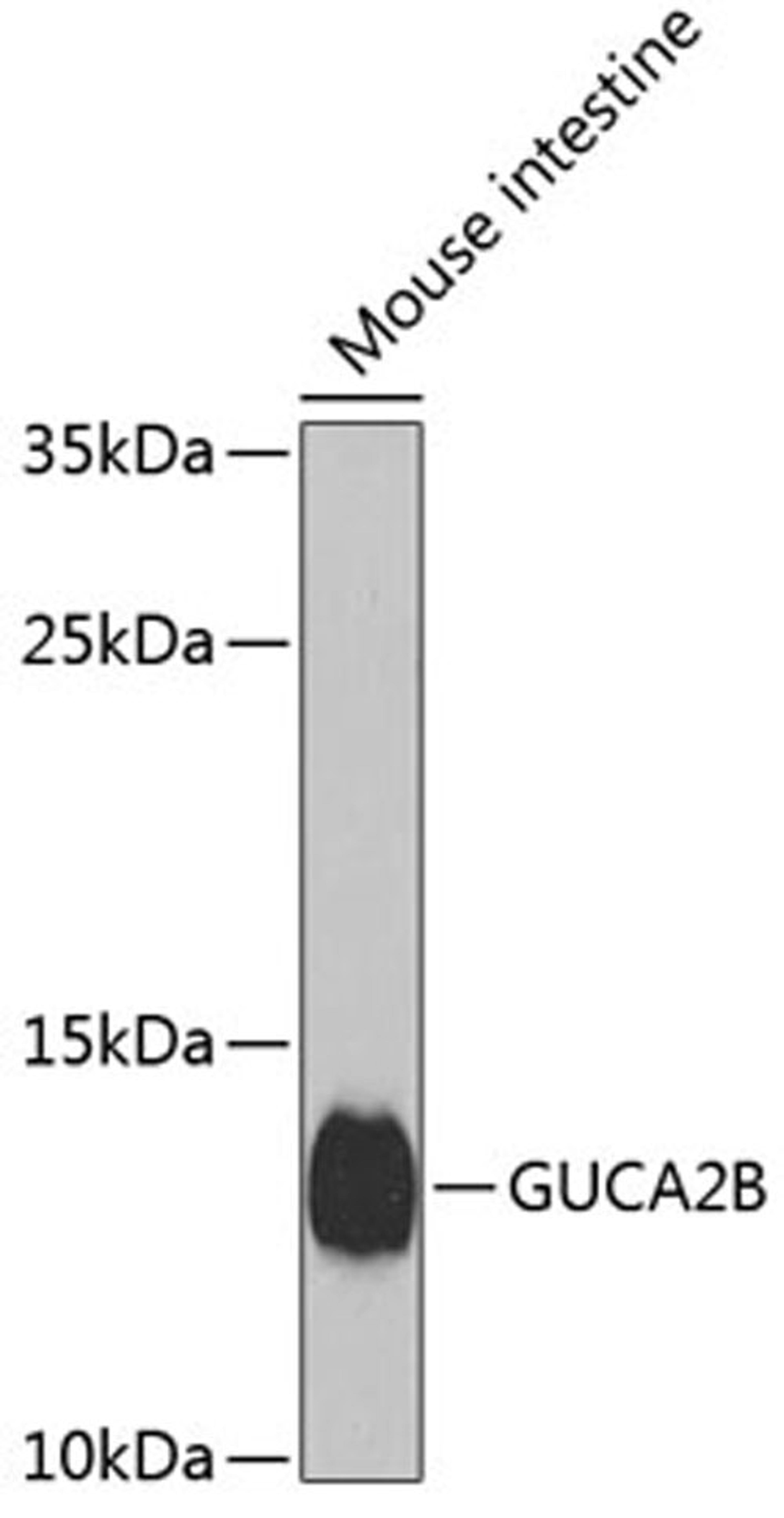 Western blot - GUCA2B antibody (A8390)