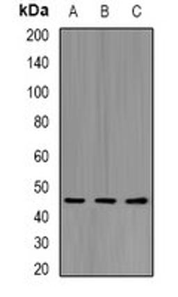 Western blot analysis of HepG2 (Lane1), mouse liver (Lane2), mouse heart (Lane3) whole cell lysates using KIR2DL3 antibody