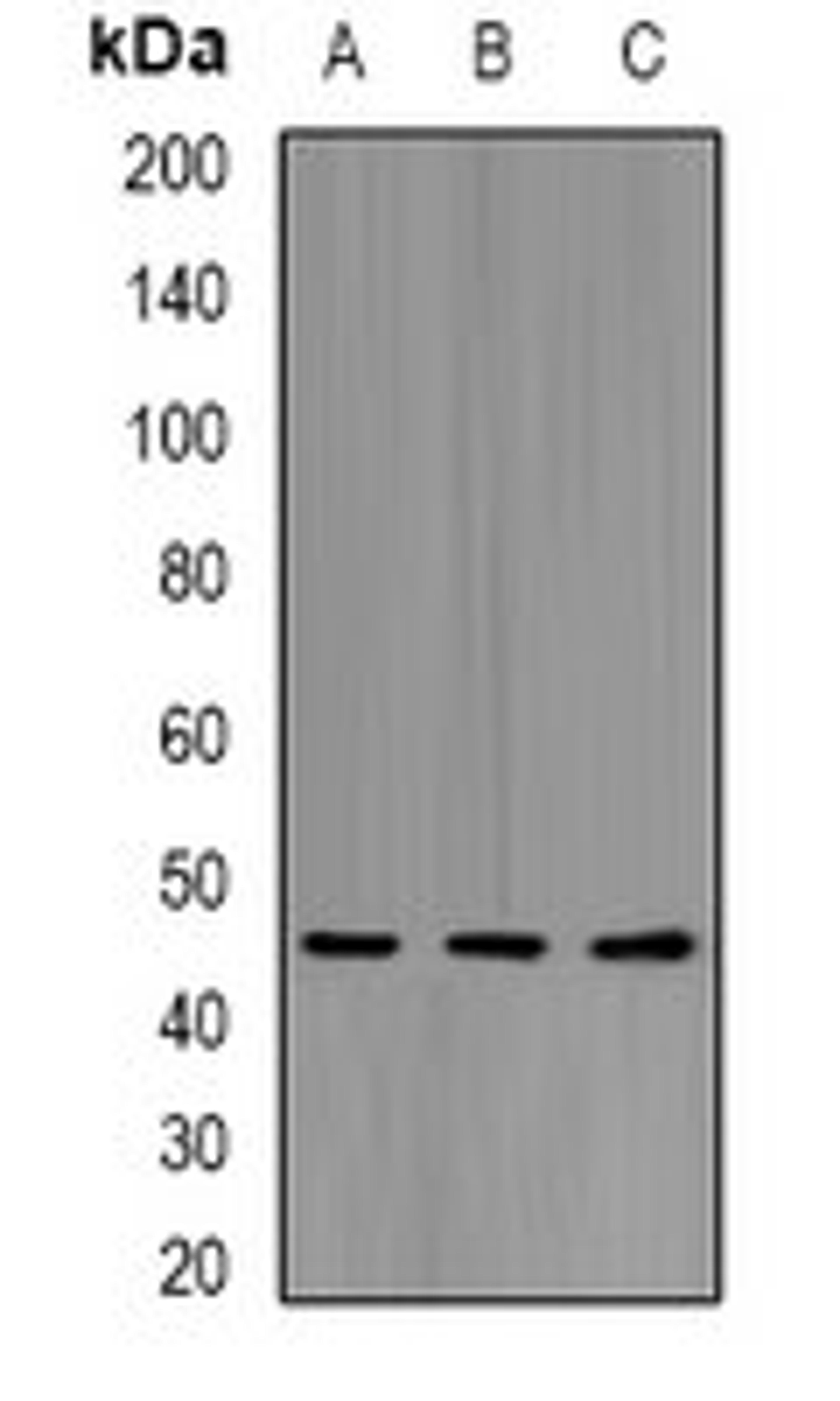 Western blot analysis of HepG2 (Lane1), mouse liver (Lane2), mouse heart (Lane3) whole cell lysates using KIR2DL3 antibody