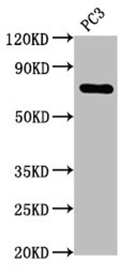 Western Blot. Positive WB detected in: PC3 whole cell lysate. All lanes: TP63 antibody at 2.1μg/ml. Secondary. Goat polyclonal to rabbit IgG at 1/50000 dilution. Predicted band size: 66, 63, 52, 56, 45, 58, 47, 68, 57, 77 KDa. Observed band size: 77 KDa.