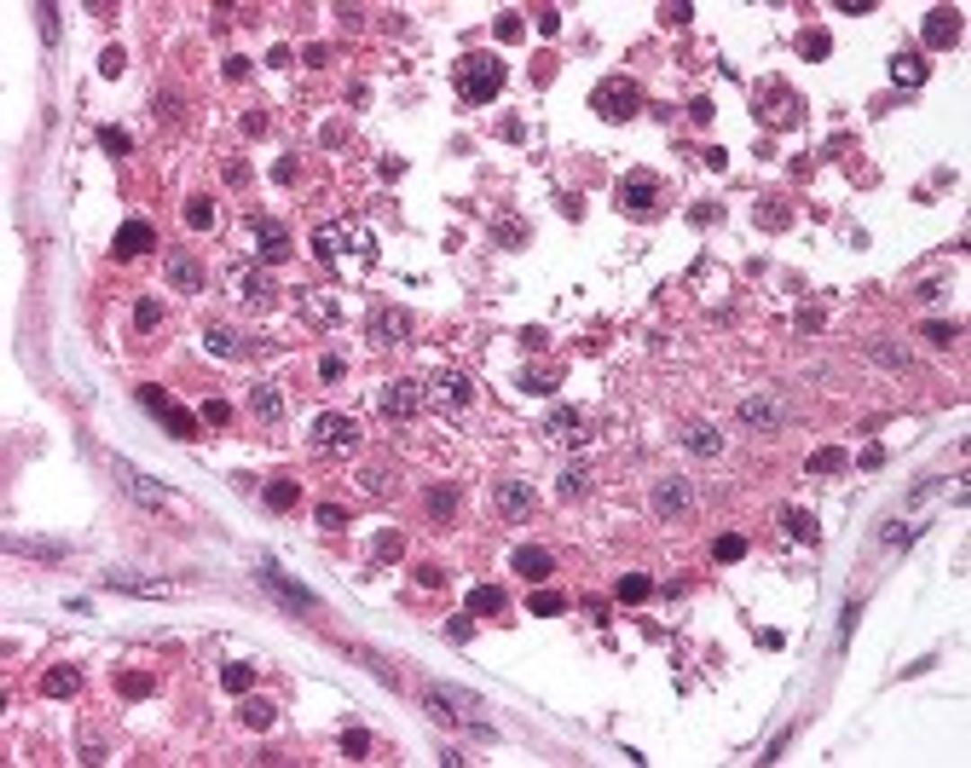 Immunohistochemistry staining of MAGEF1 in testis (formalin-fixed paraffin embedded) tissue using MAGEF1 Antibody.