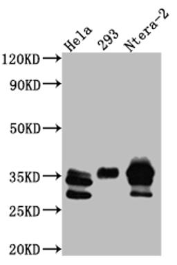 Western Blot. Positive WB detected in: Hela whole cell lysate, HEK293 whole cell lysate, Ntera-2 whole cell lysate. All lanes: Caspase-3 antibody at 1:1000. Secondary. Goat polyclonal to rabbit IgG at 1/50000 dilution. Predicted band size: 32 kDa. Observed band size: 32, 28 kDa.