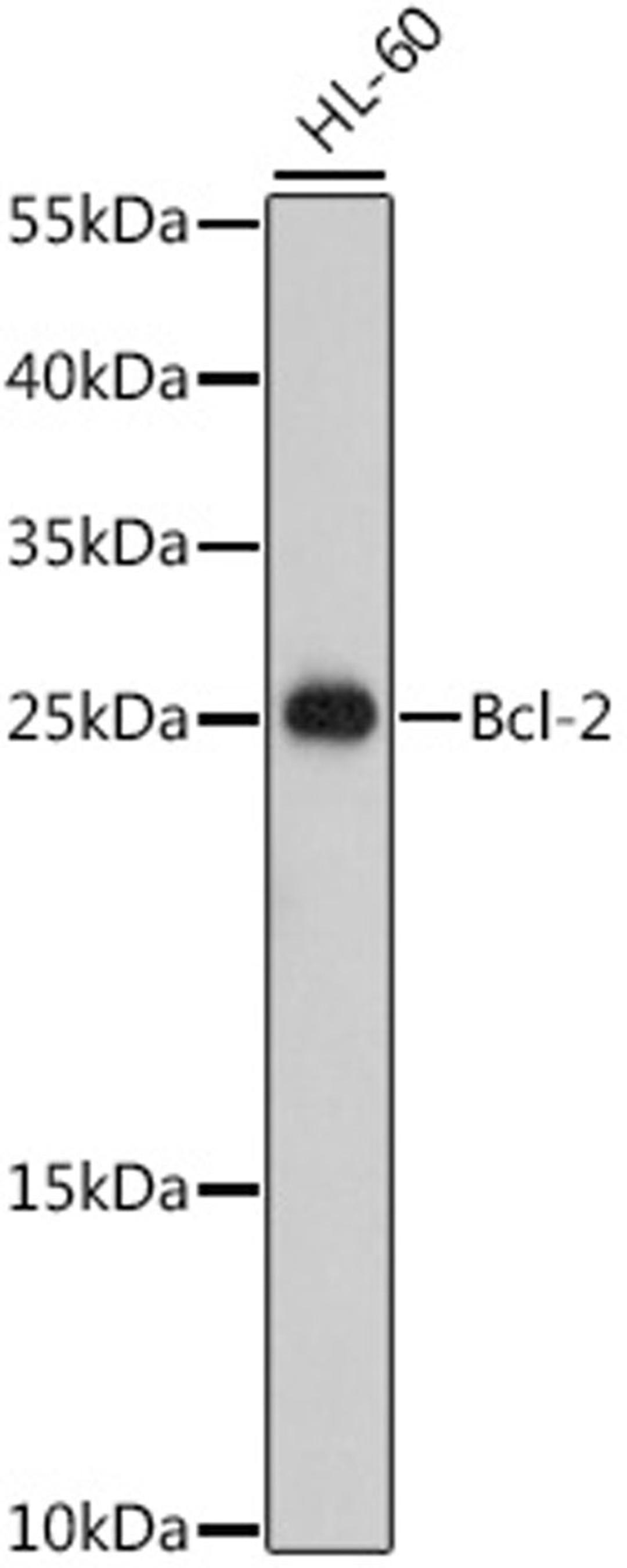 Western blot - Bcl-2 antibody (A0208)