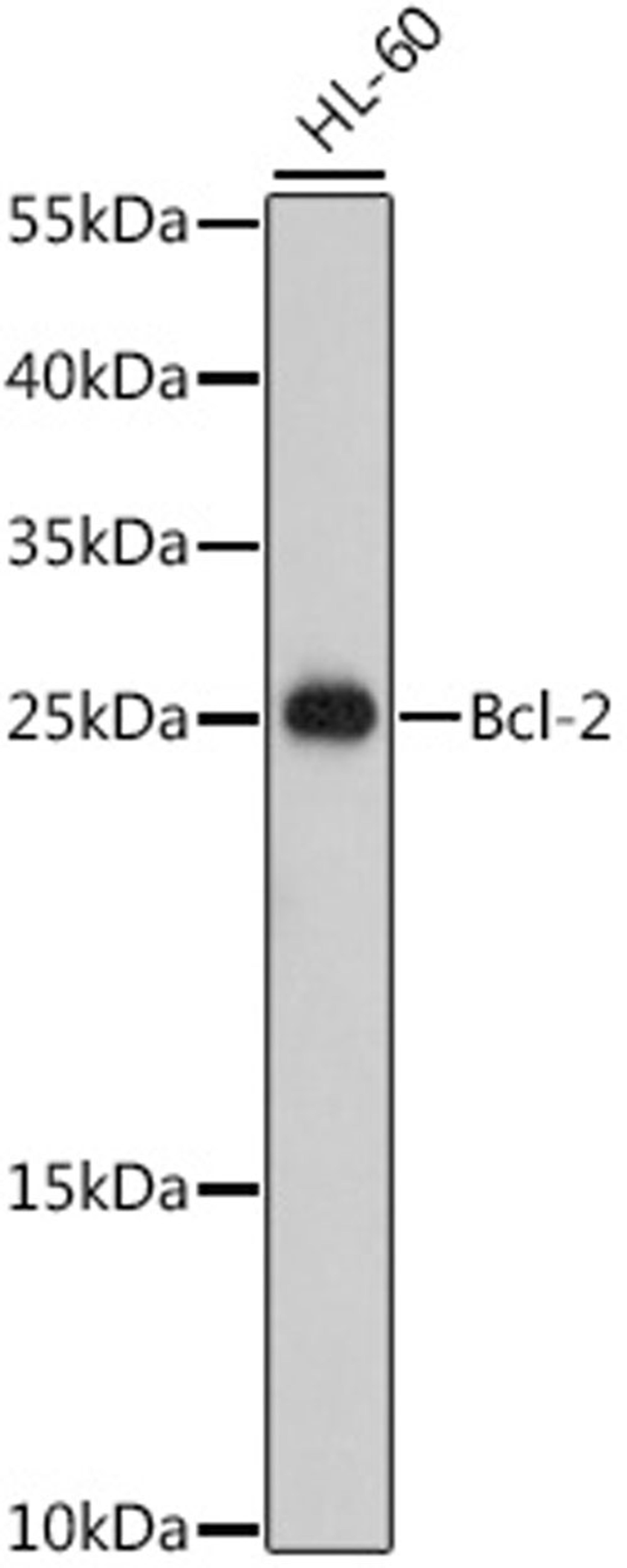 Western blot - Bcl-2 antibody (A0208)