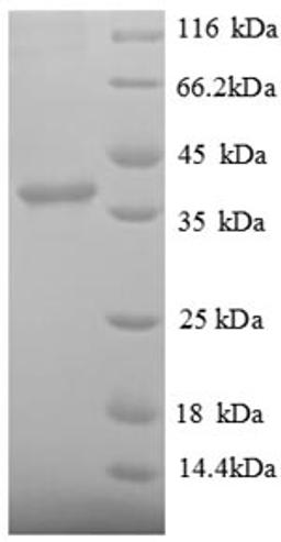 (Tris-Glycine gel) Discontinuous SDS-PAGE (reduced) with 5% enrichment gel and 15% separation gel.
