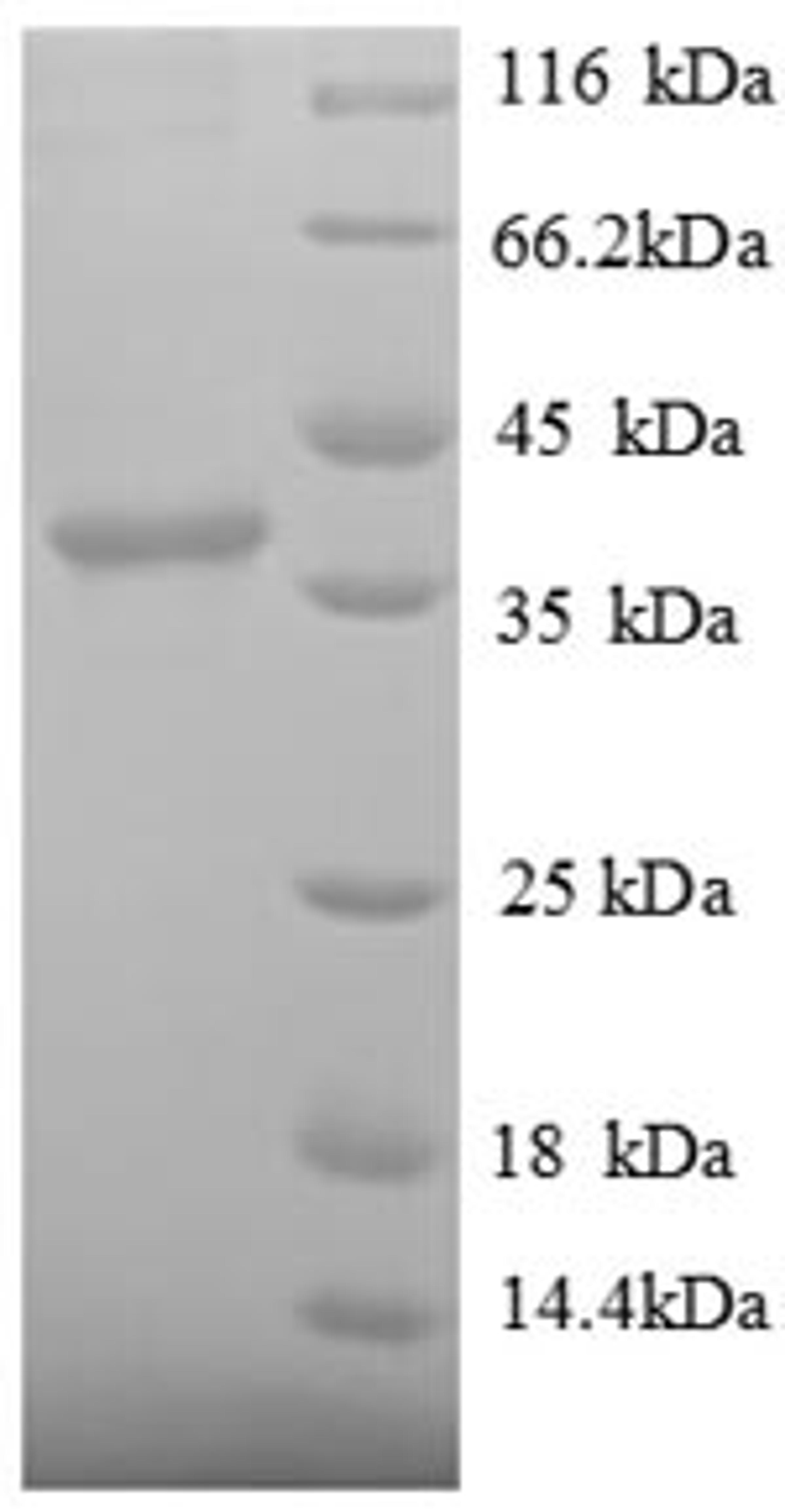 (Tris-Glycine gel) Discontinuous SDS-PAGE (reduced) with 5% enrichment gel and 15% separation gel.