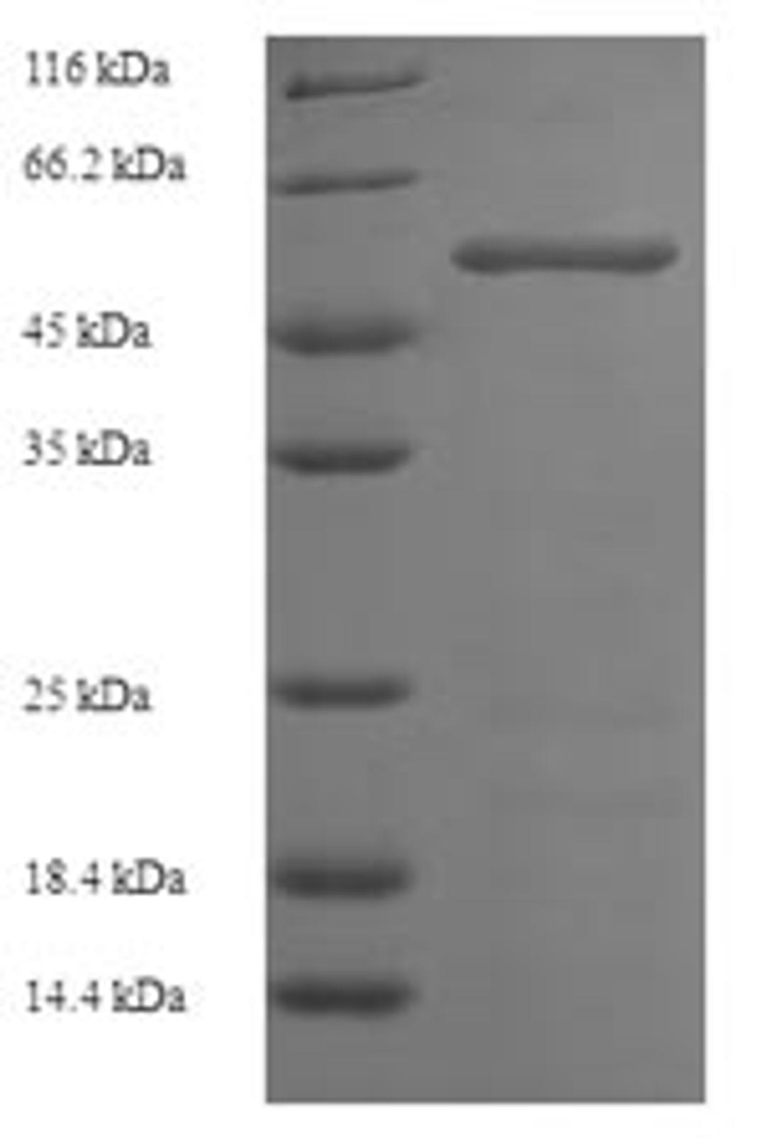 (Tris-Glycine gel) Discontinuous SDS-PAGE (reduced) with 5% enrichment gel and 15% separation gel.
