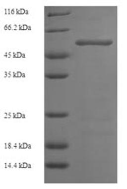 (Tris-Glycine gel) Discontinuous SDS-PAGE (reduced) with 5% enrichment gel and 15% separation gel.