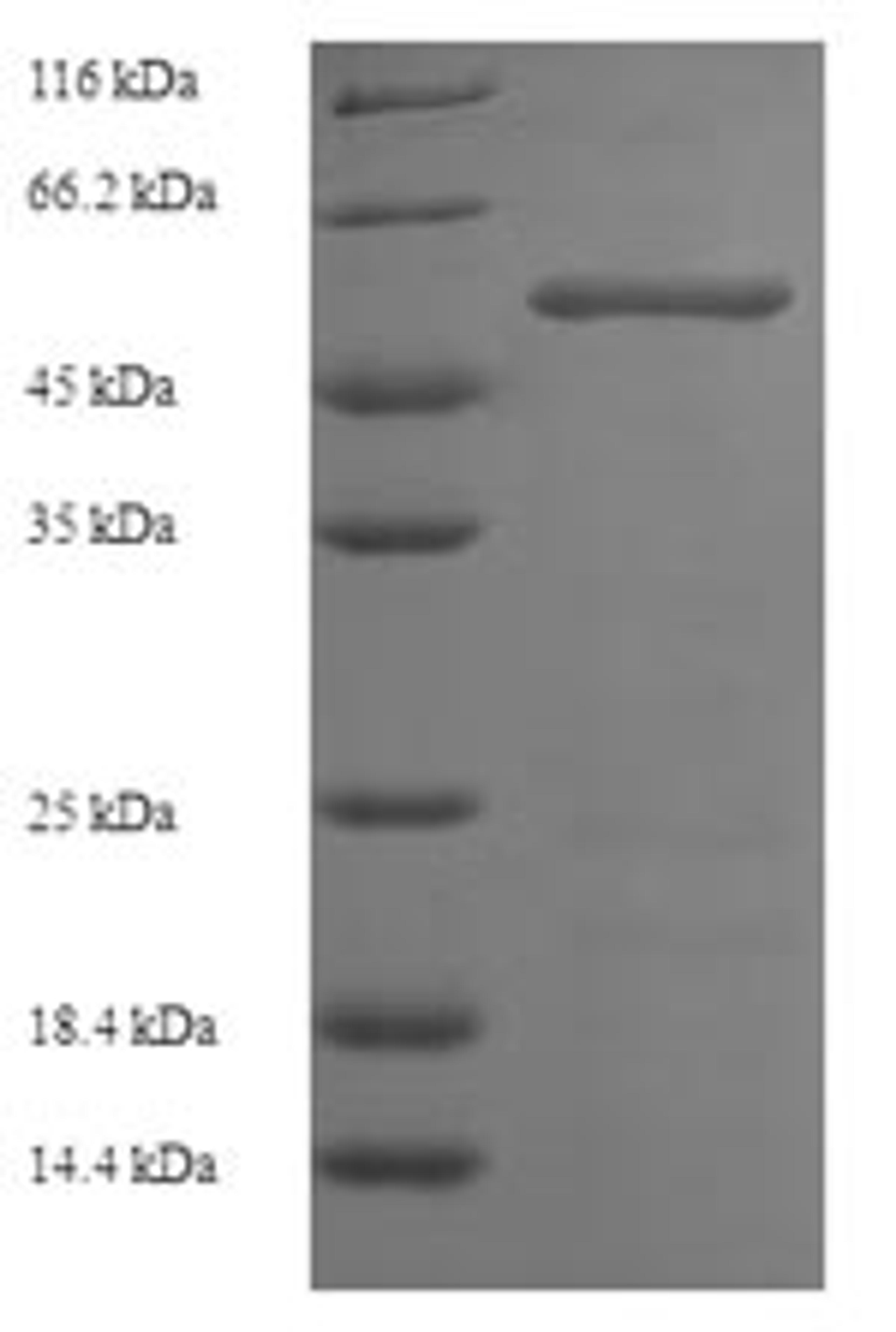 (Tris-Glycine gel) Discontinuous SDS-PAGE (reduced) with 5% enrichment gel and 15% separation gel.