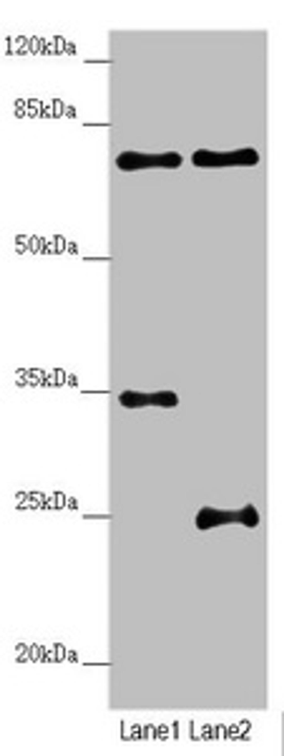 Western blot. All lanes: NEDD1 antibody at 3.25ug/ml. Lane 1: Mouse small intestine tissue. Lane 2: Jurkat whole cell lysate. Secondary. Goat polyclonal to rabbit IgG at 1/10000 dilution. Predicted band size: 72, 63, 73 kDa. Observed band size: 72 kDa. 