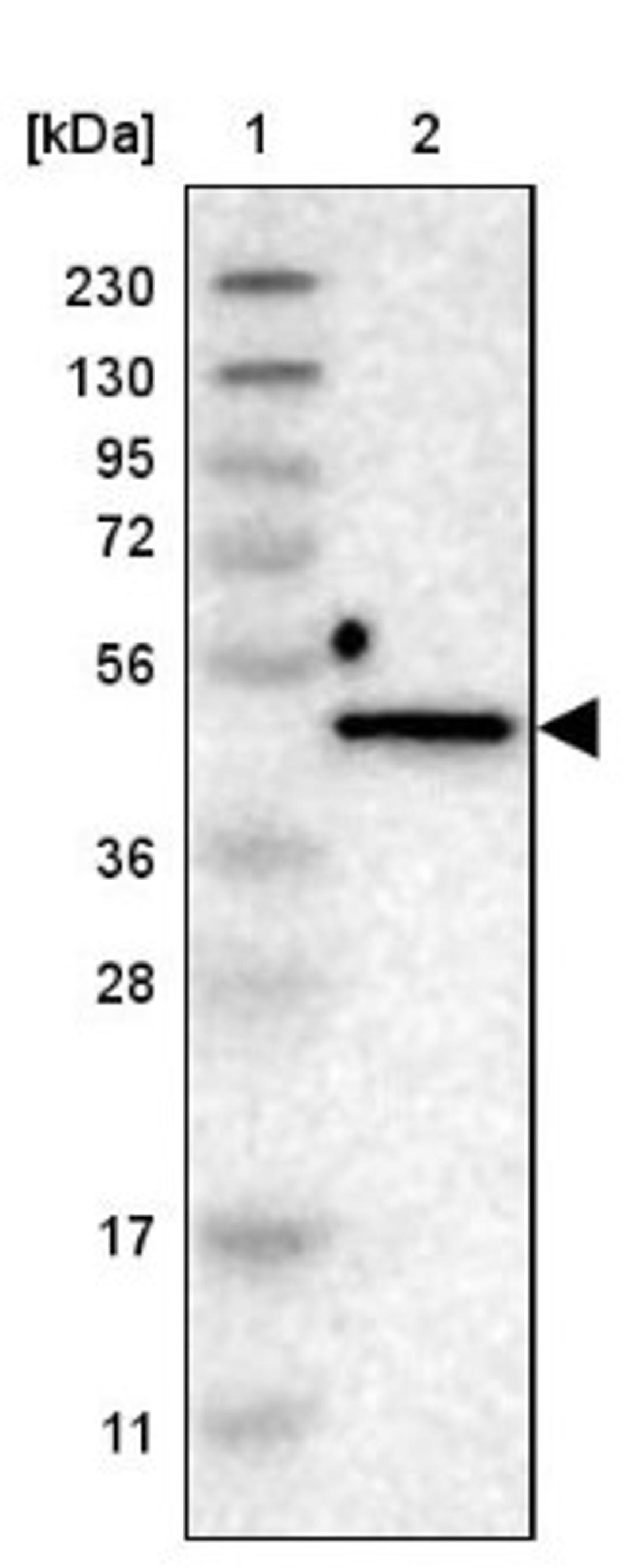 Western Blot: thymocyte selection-associated high mobility group box Antibody [NBP1-87857] - Lane 1: Marker [kDa] 230, 130, 95, 72, 56, 36, 28, 17, 11<br/>Lane 2: Human cell line RT-4