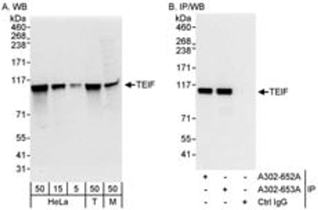 Detection of human and mouse TEIF by western blot (h&m) and immunoprecipitation (h).