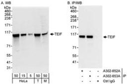 Detection of human and mouse TEIF by western blot (h&m) and immunoprecipitation (h).