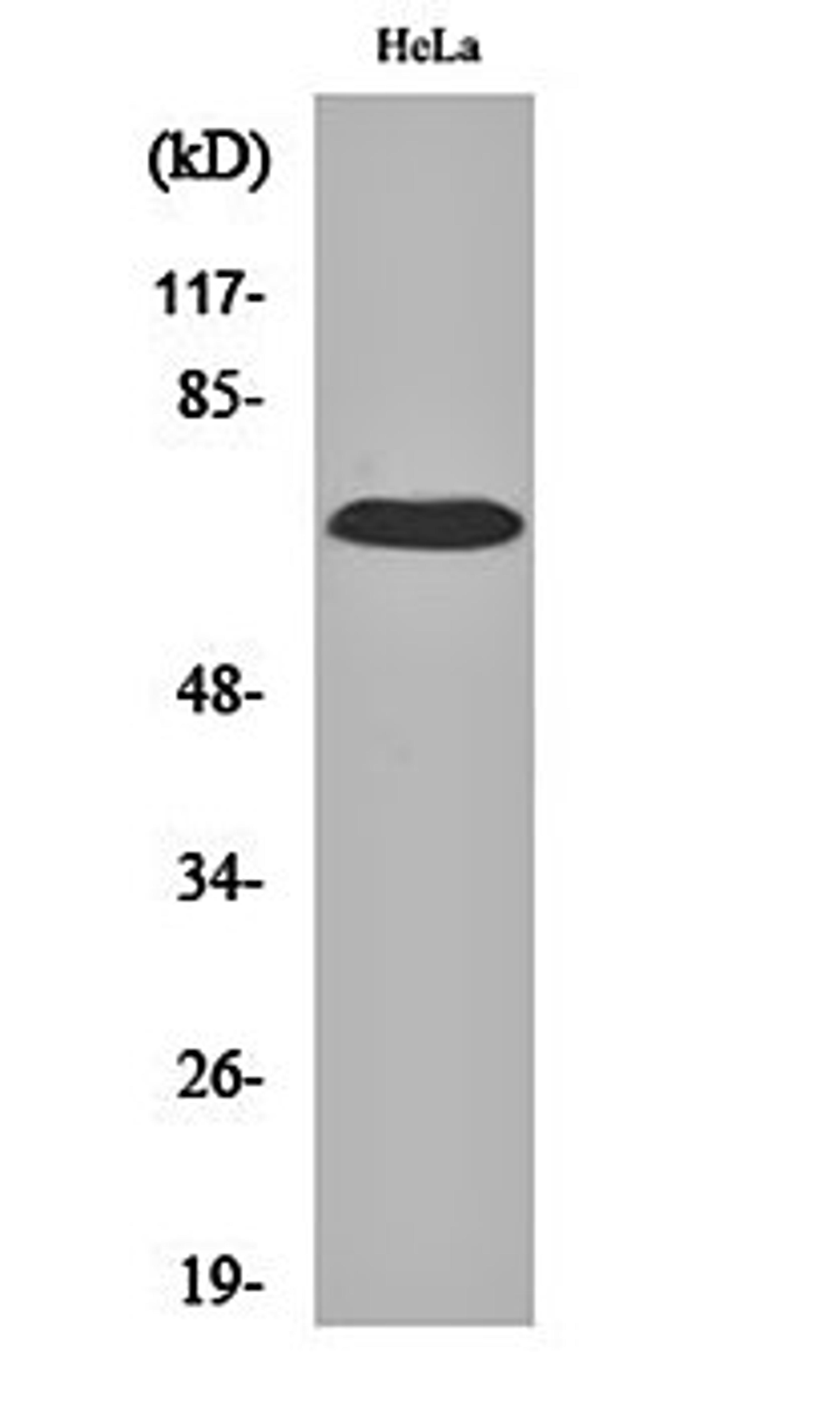 Western blot analysis of Hela cell lysates using IL-17RC antibody