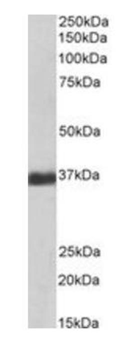 Western blot analysis of Human Liver lysate using GAPDH antibody (Biotin)