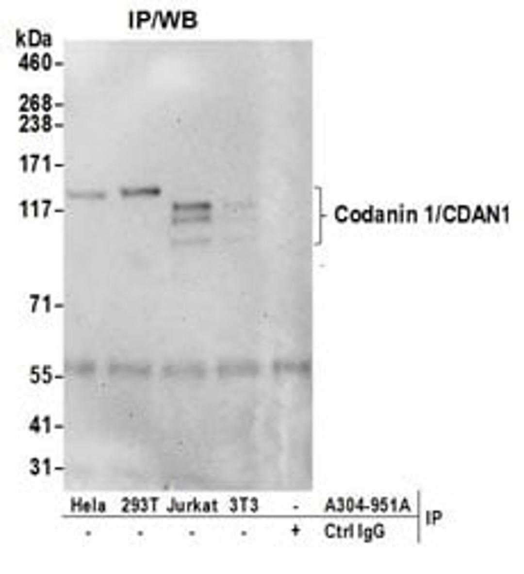 Detection of human Codanin 1/CDAN1 by western blot of immunoprecipitates.