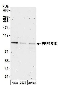 Detection of human PPP1R18 by WB.