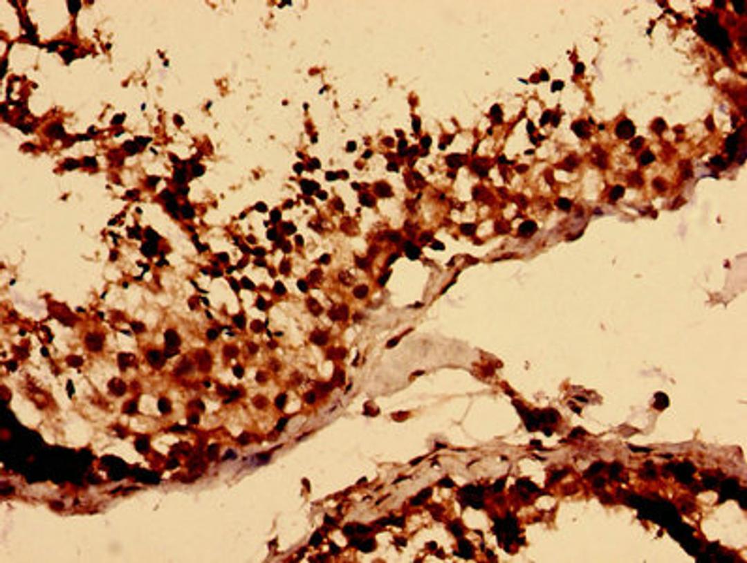 Immunohistochemistry analysis of human testis tissue using CSB-PA013249LA01HU at dilution of 1:100