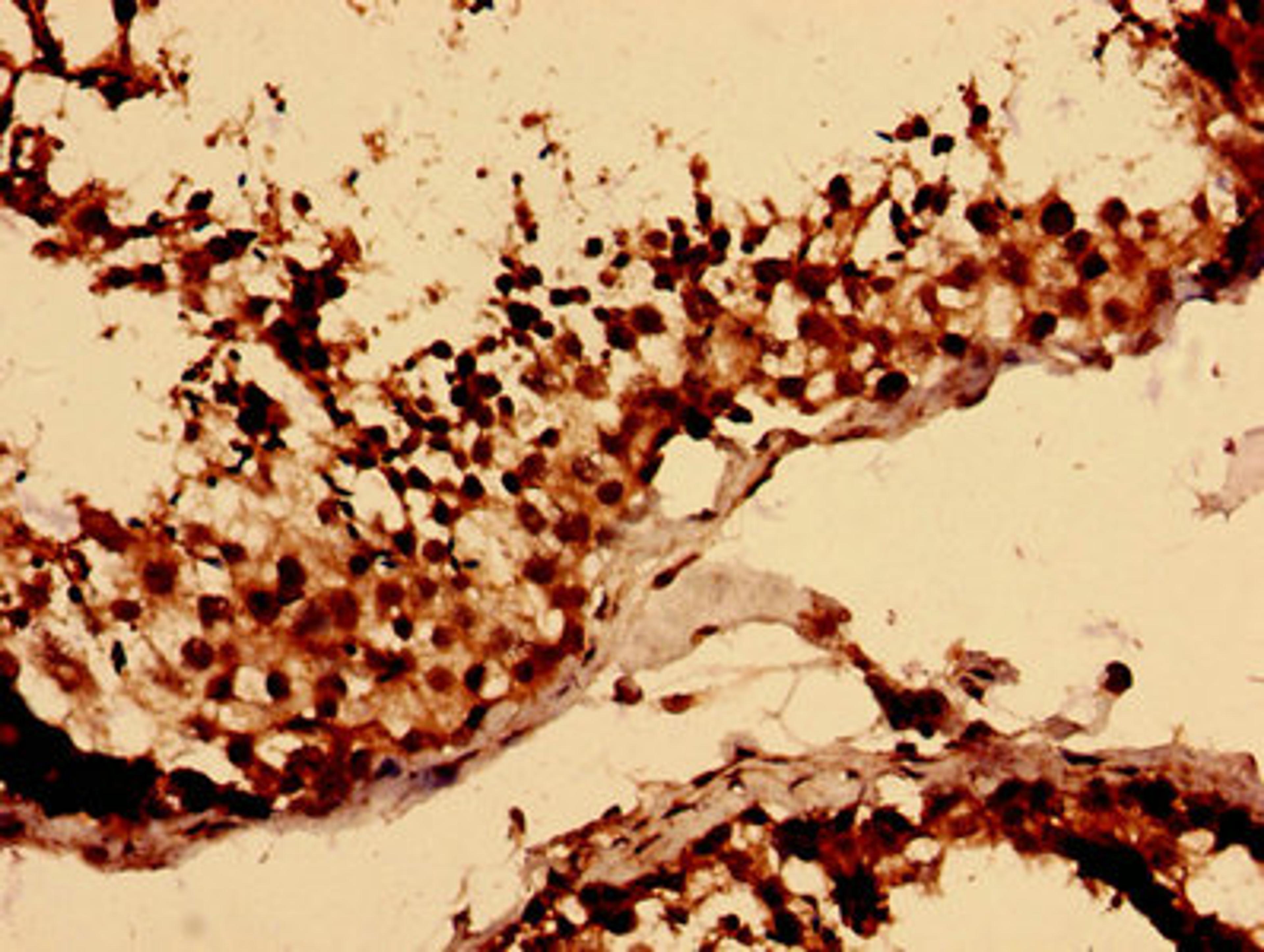 Immunohistochemistry analysis of human testis tissue using CSB-PA013249LA01HU at dilution of 1:100