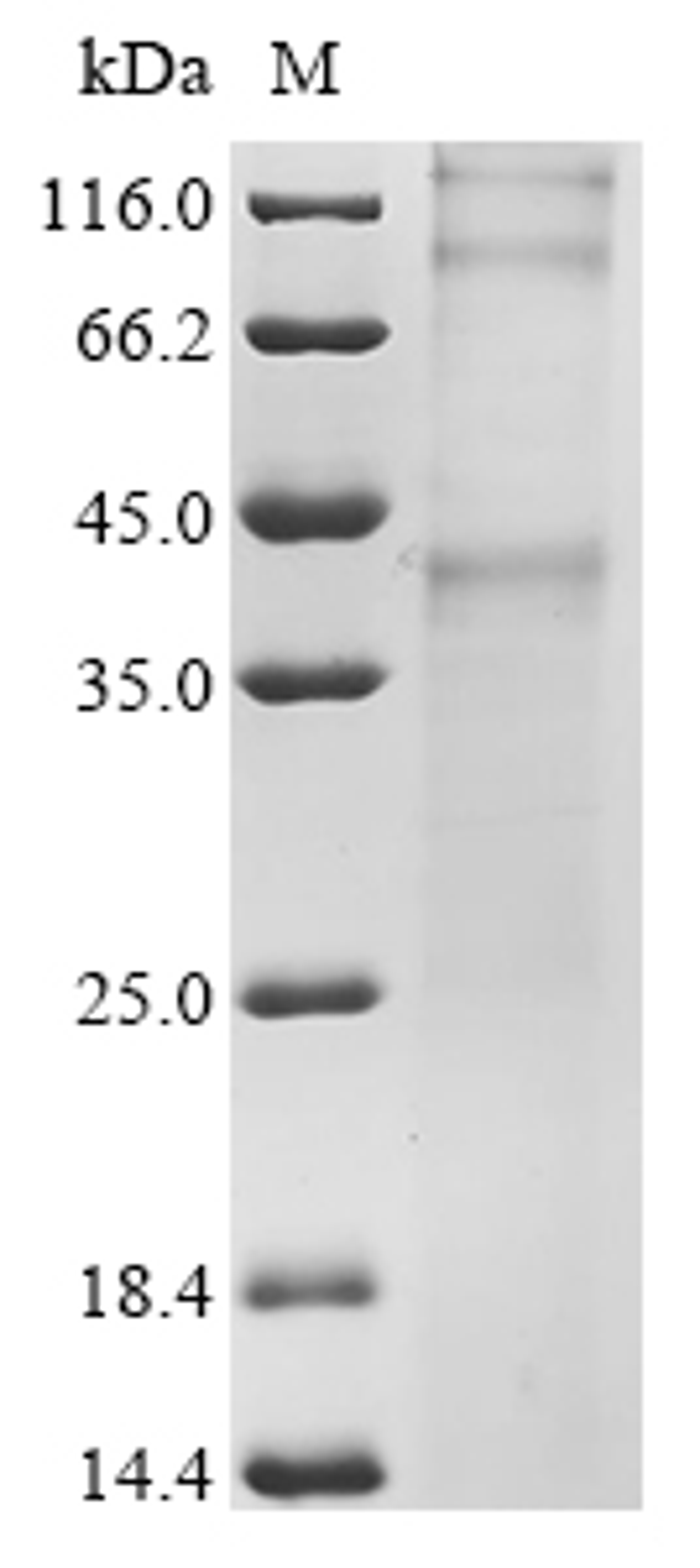 (Tris-Glycine gel) Discontinuous SDS-PAGE (reduced) with 5% enrichment gel and 15% separation gel.