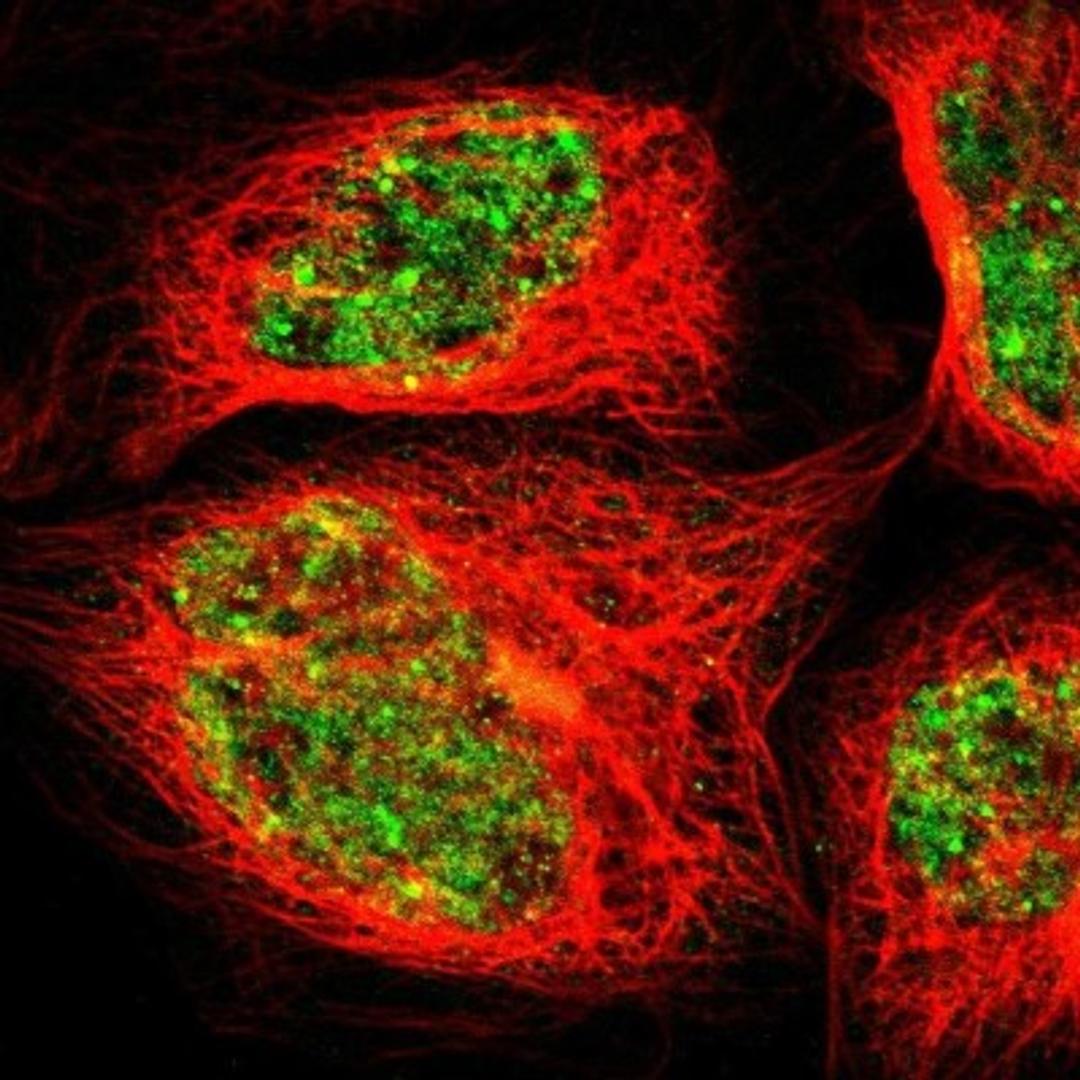 Immunocytochemistry/Immunofluorescence: GAB3 Antibody [NBP1-86111] - Immunofluorescent staining of human cell line A-431 shows positivity in nucleus but not nucleoli.