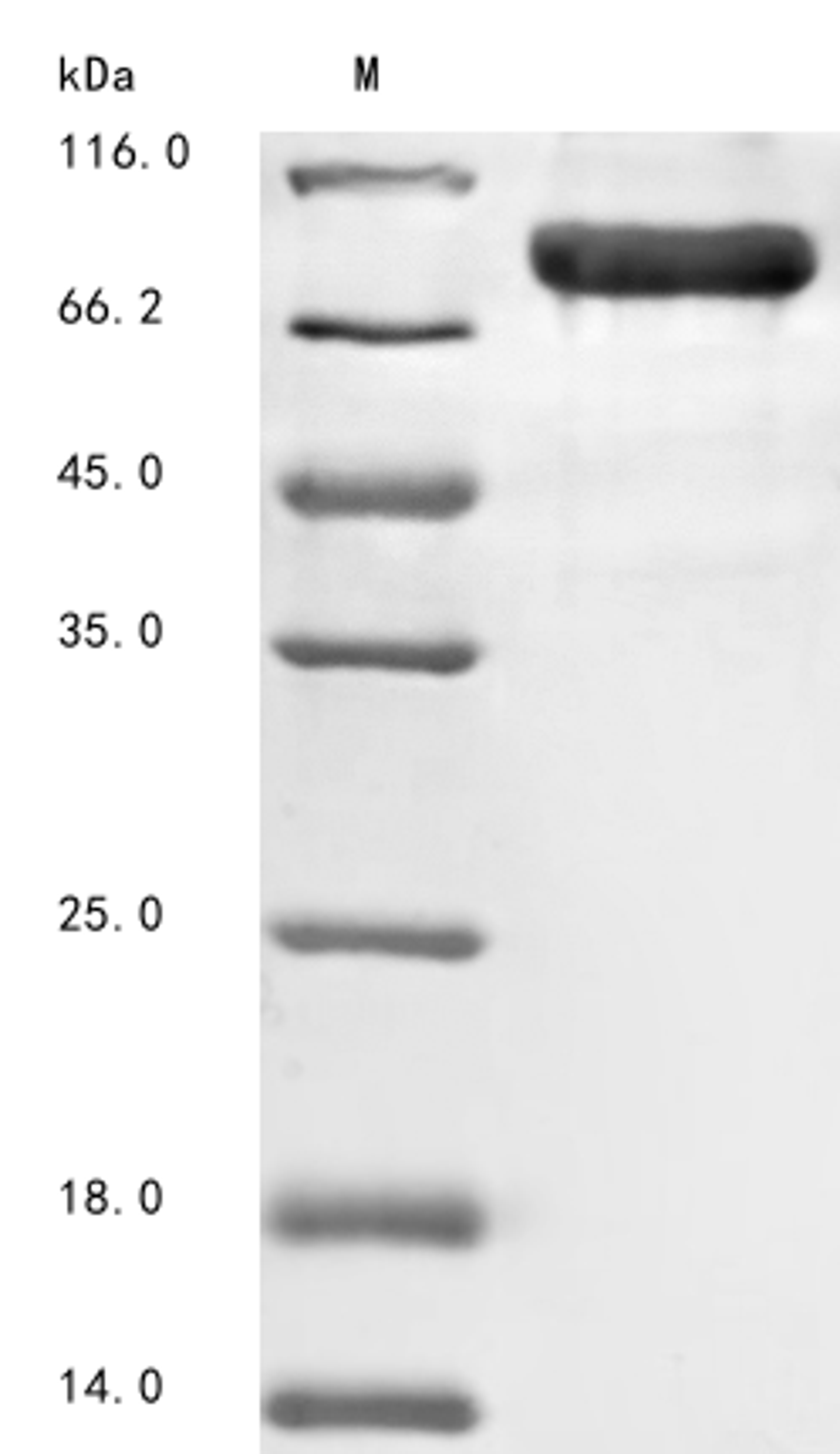 (Tris-Glycine gel) Discontinuous SDS-PAGE (reduced) with 5% enrichment gel and 15% separation gel.