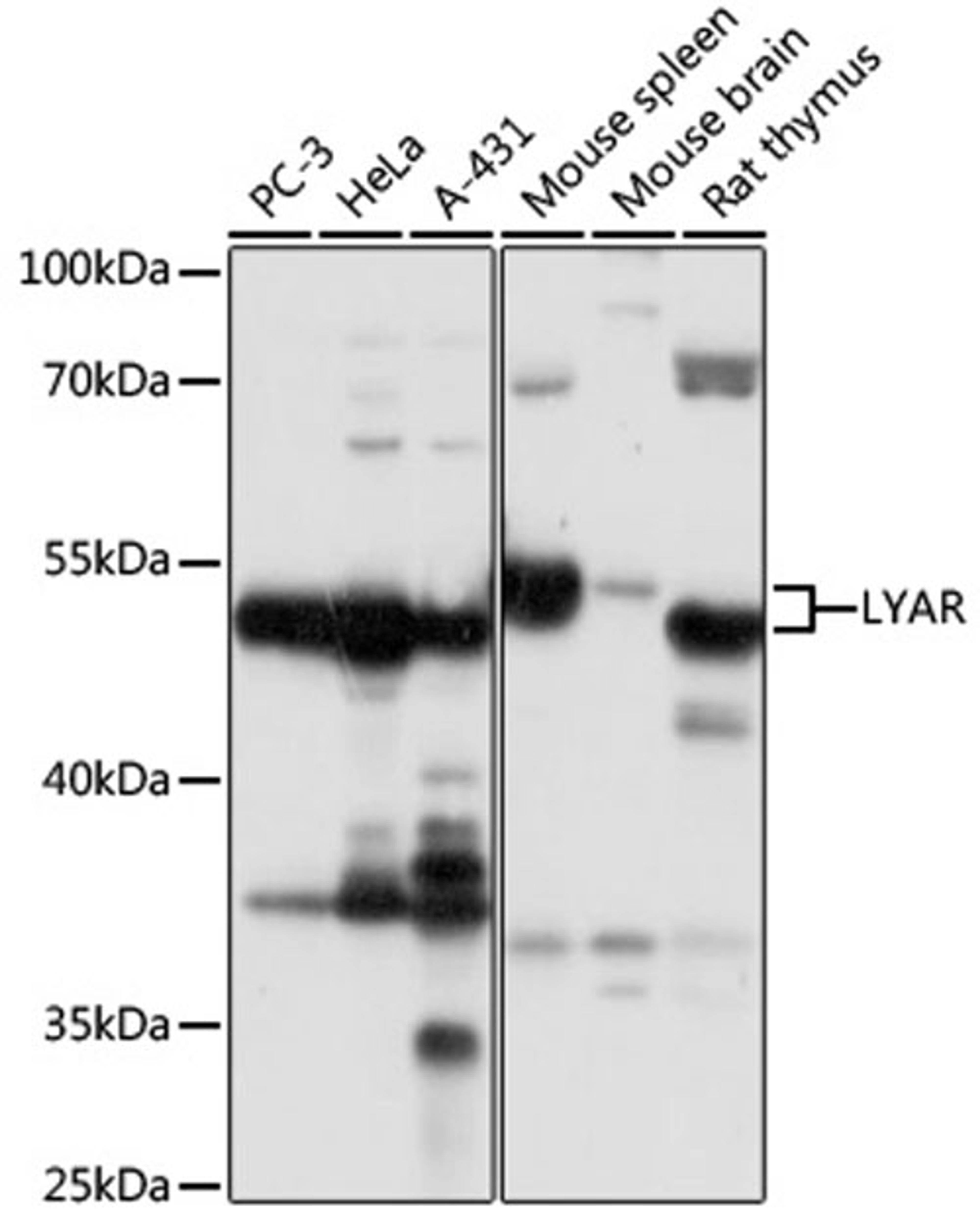 Western blot - LYAR antibody (A17724)