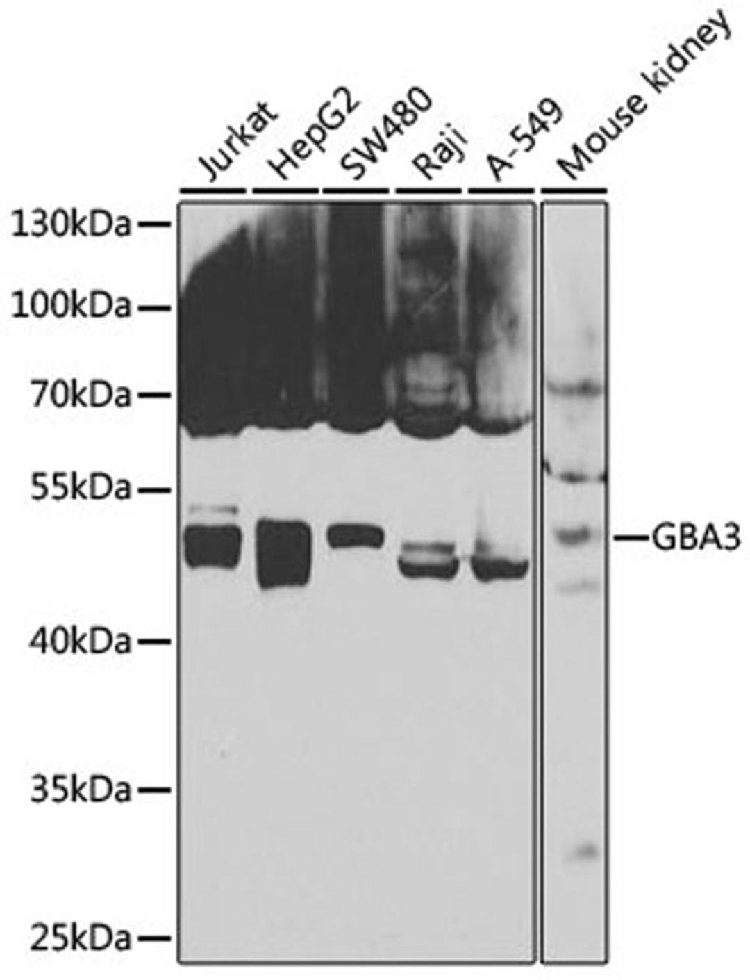 Western blot - GBA3 antibody (A7827)