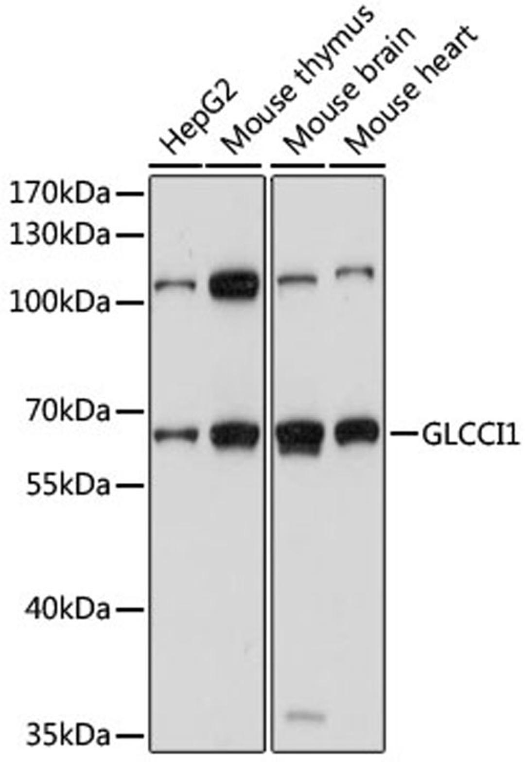 Western blot - GLCCI1 antibody (A15934)