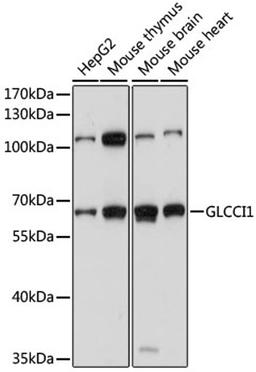 Western blot - GLCCI1 antibody (A15934)