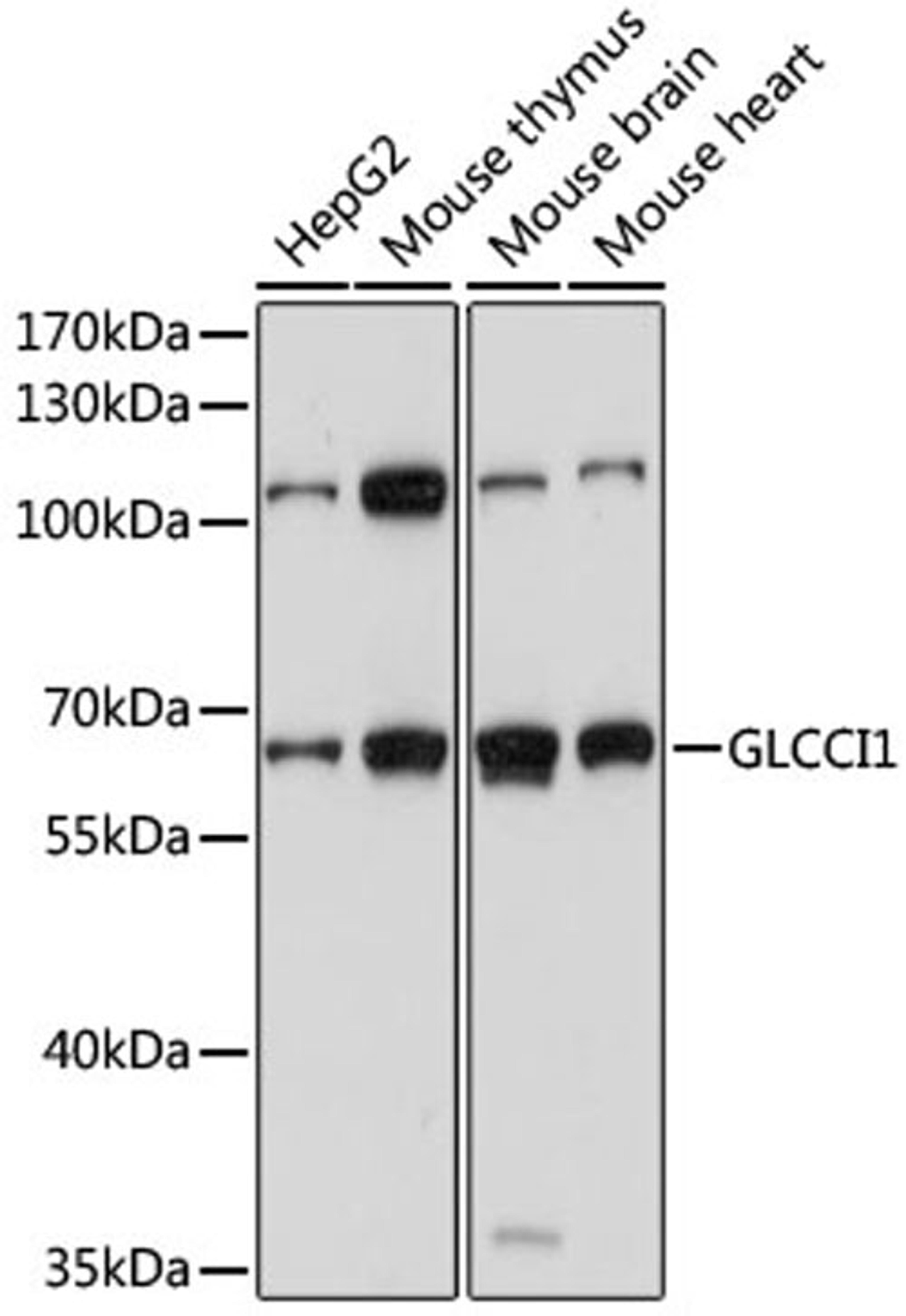 Western blot - GLCCI1 antibody (A15934)