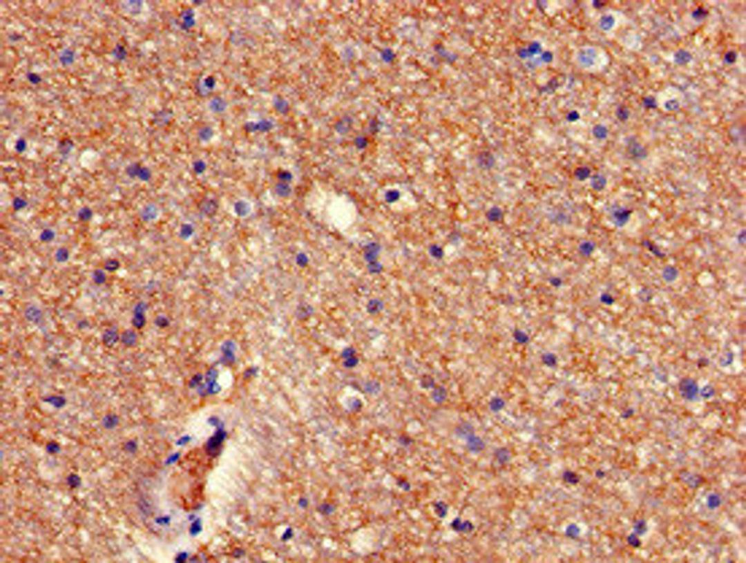 Immunohistochemistry of paraffin-embedded human brain tissue using CSB-PA880939LA01HU at dilution of 1:100